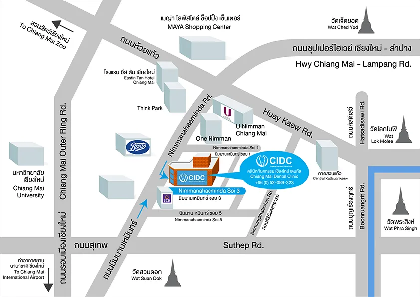 จัดฟันใส เชียงใหม่